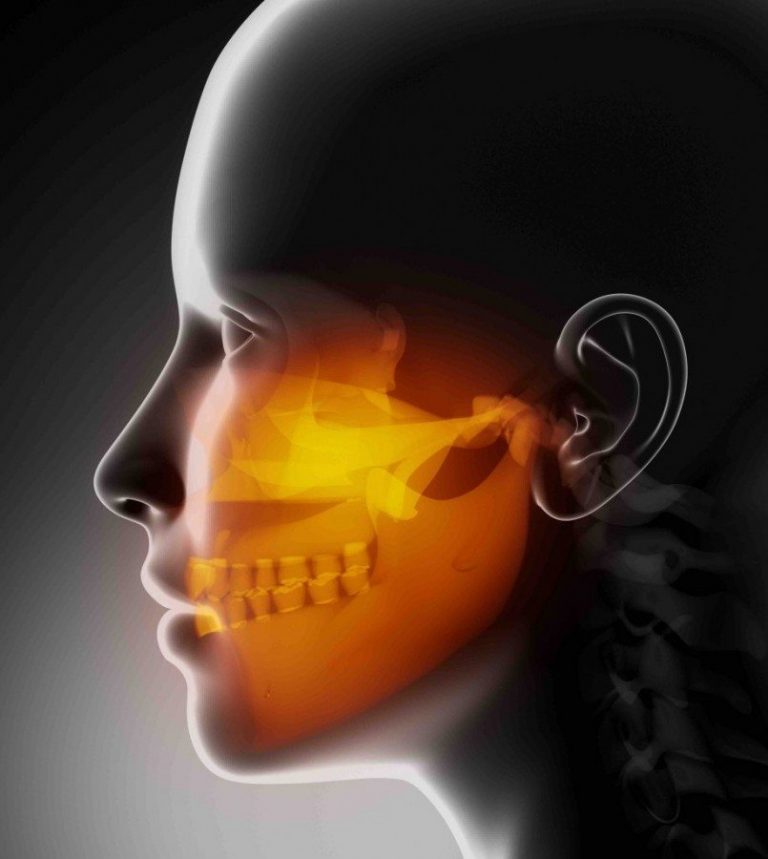 TMJ Disorders and Treatment