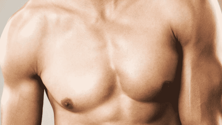 Male Breast Reduction