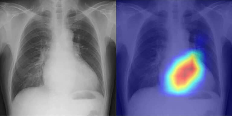 Chest radiograph